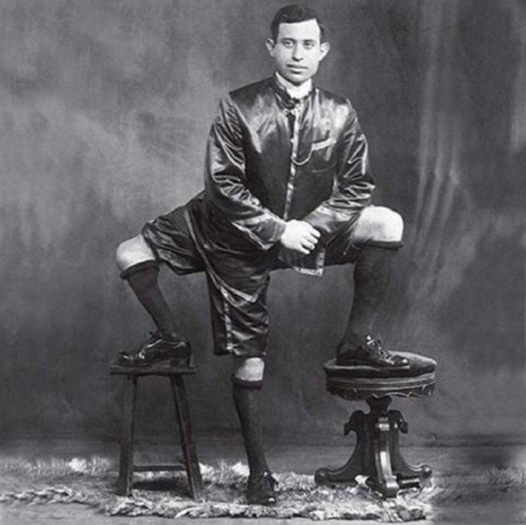 Frank Lentini hatte drei Beine und andere Körperteile aufgrund eines verbundenen parasitären Zwillings.